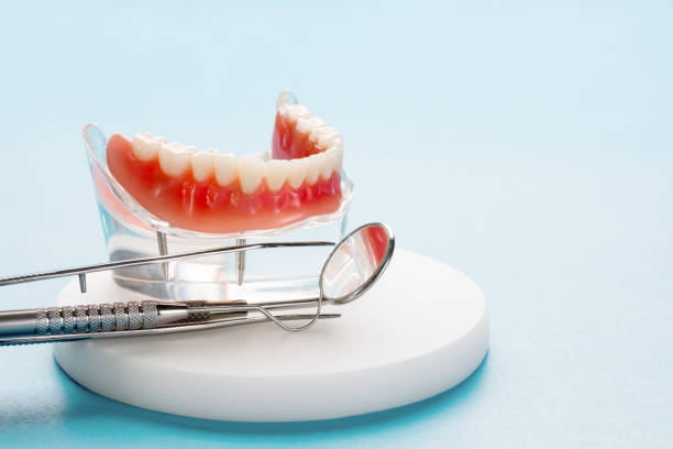 Dental Inlays and Onlays in Evansville, WY