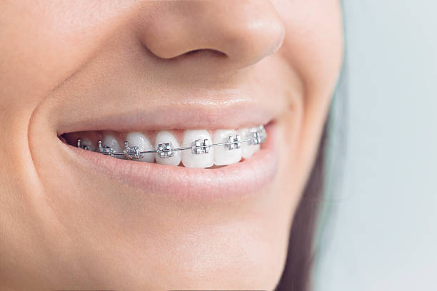 Best Full Mouth Reconstruction  in Evansville, WY